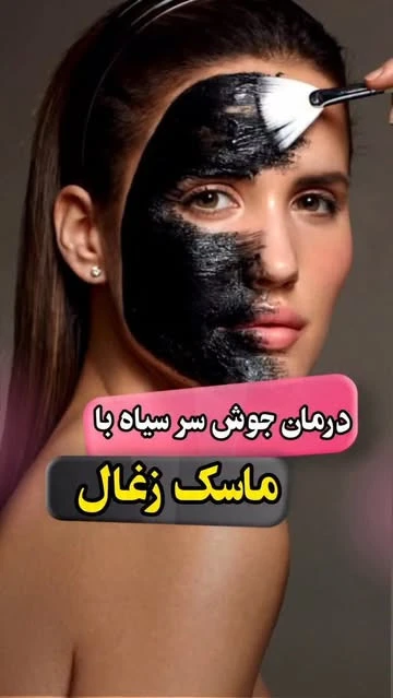 ماسک زغال