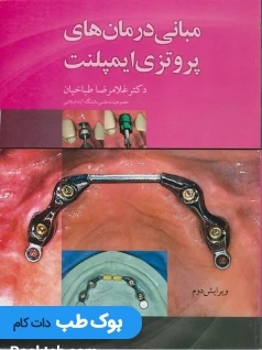 مبانی درمان پروتزی ایمپلنت