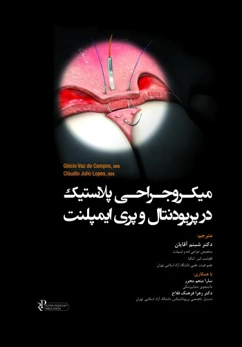 میکروجراحی پلاستیک در پریودنتال و پری ایمپلنت