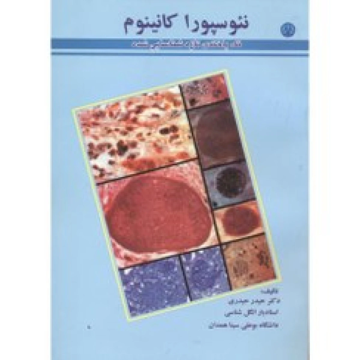 نئوسپورا کانینوم ( تک یاخته تازه شناسایی شده ) / حیدر حیدری / نشردانشجو همدان