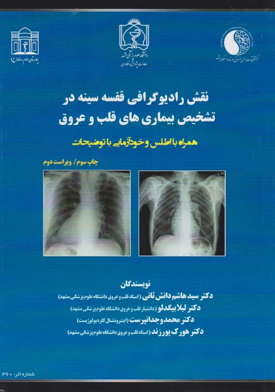 نقش رادیوگرافی قفسه سینه در تشخیص بیماری های قلب و عروق