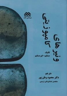 ونیرهای کامپوزیتی (تکنیک مستقیم – غیر مستقیم )