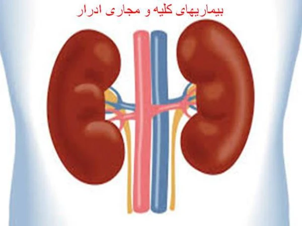 پاورپوینت بیماریهای کلیه و مجاری ادرار