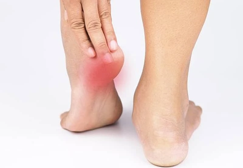 پد ژله ای کف پا اوریفلیم
