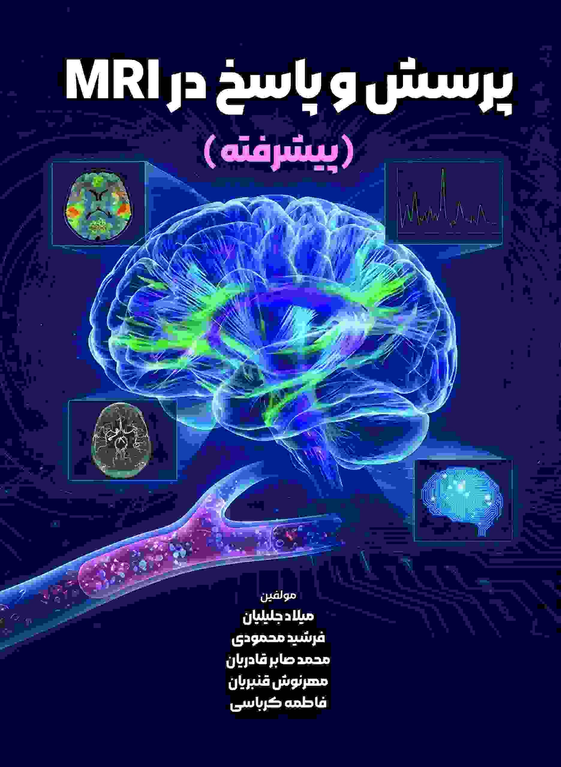 پرسش و پاسخ در MRI (پیشرفته)