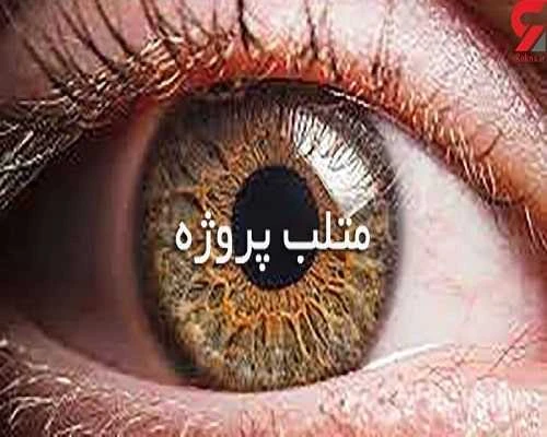 پروژه تعقیب حرکت عنبیه چشم با متلب