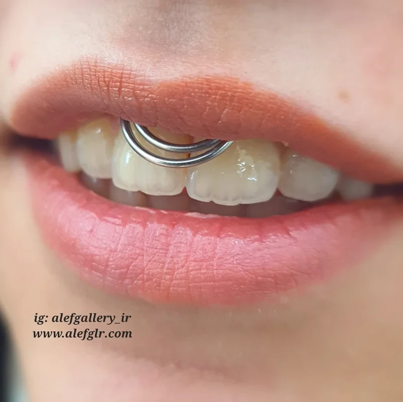 پیرسینگ اسمایل حلقه ای استیل