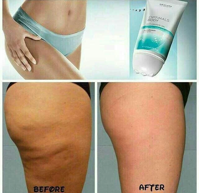 ژل آنتی سلولیت اوریفلیم اورجینال