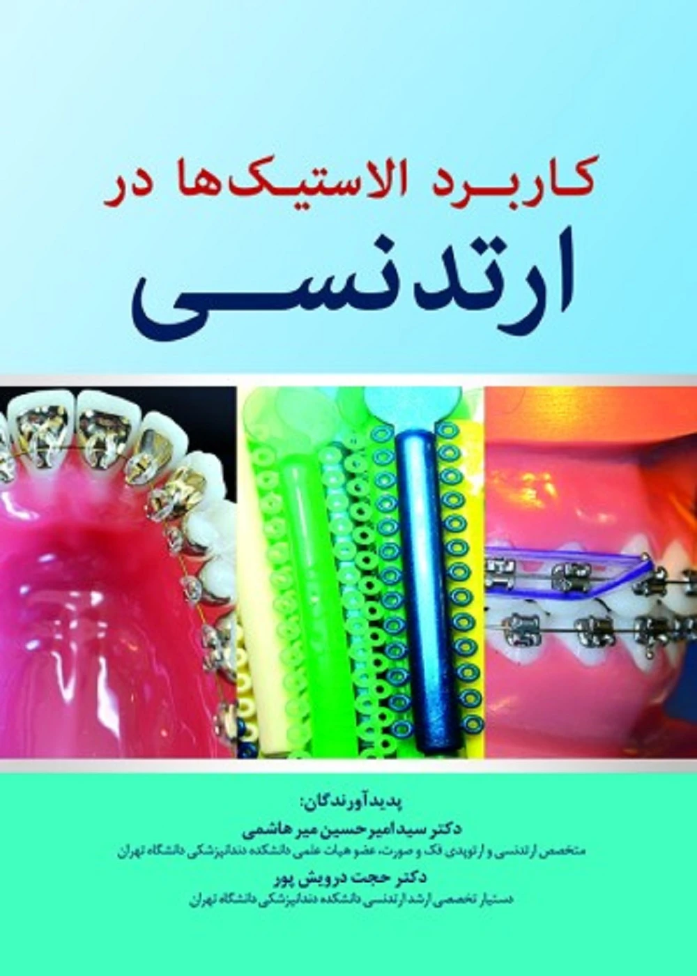 کاربرد الاستیک ها در ارتدنسی
