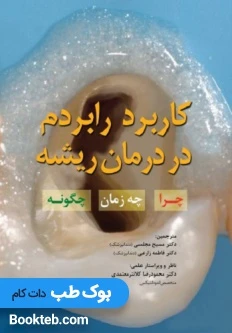 کاربرد رابردم در درمان ریشه (چرا – چه زمان – چگونه)