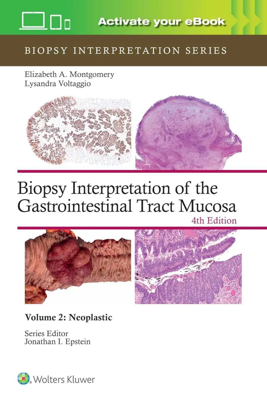 کتاب Biopsy Interpretation of the Gastrointestinal Tract Mucosa: Neoplastic, 2024 زبان اصلی