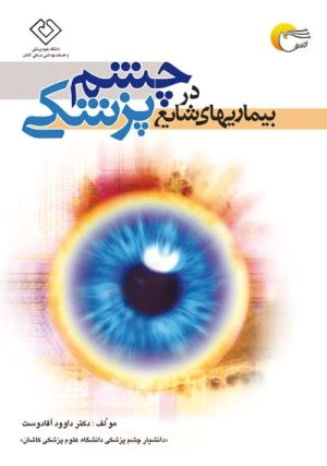 کتاب بیماری های شایع در چشم پزشکی