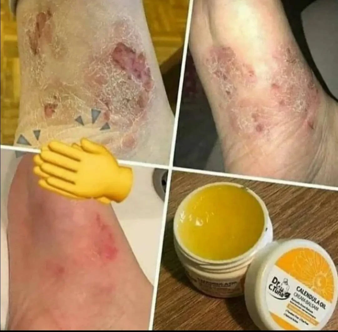 کرم بالسام آینه صفا ( کالندولا) فارماسی بسته بندی جدید