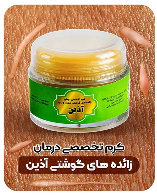 ⚜️کرم تخصصی درمان زائده های گوشتی ( کلوئید ) صورت و بدن آذین