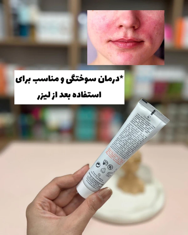 کرم ترمیم کننده اون مدل سیکالفیت حجم 100 میلی لیتر(ارسال رایگان)