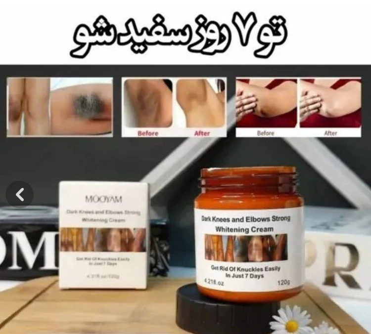 کرم سفید کننده زانو و آرنج مویام