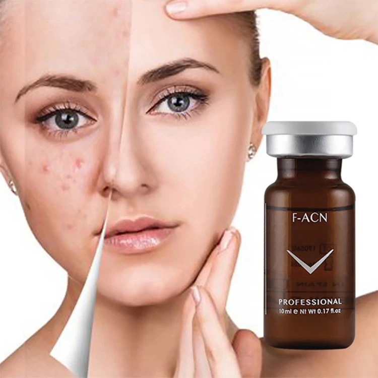 کوکتل ضد جوش فیوژن F-ACN