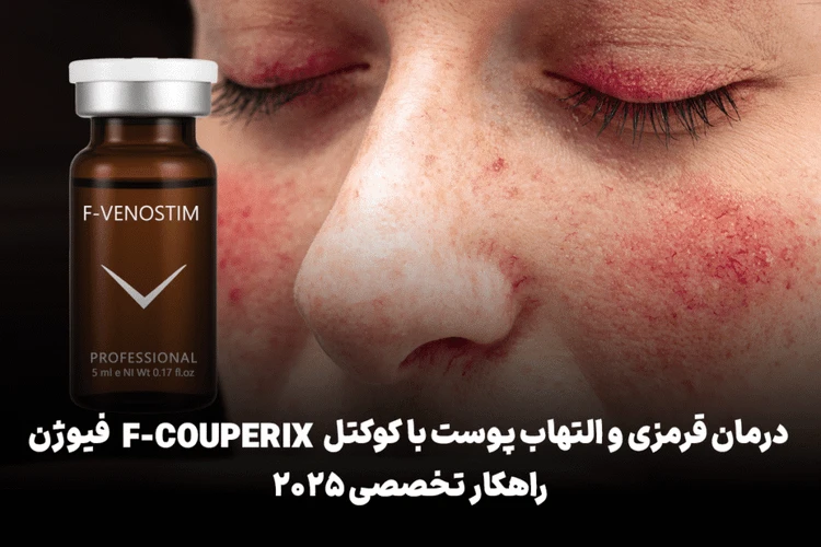 کوکتل مزوتراپی ضد قرمزی F-Couperix/F-Venostim