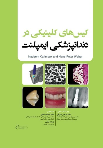 کیس های کلینیکی در دندانپزشکی ایمپلنت