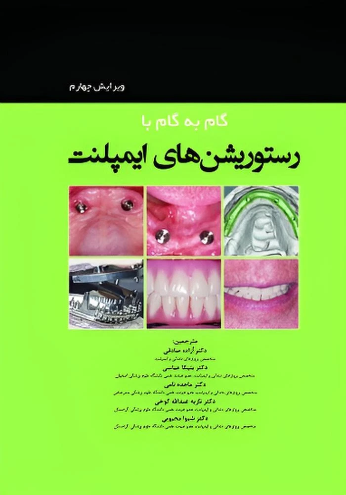 گام‌به‌گام با رستوریشن‌های ایمپلنت