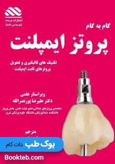 گام به گام پروتز های ایمپلنت دندان، قالبگیری و تحویل پروتزهای ثابت ایمپلنت همراه با ویدیو آموزشی